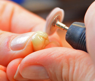 Zahntechnisches Labor in der Zahnarztpraxis